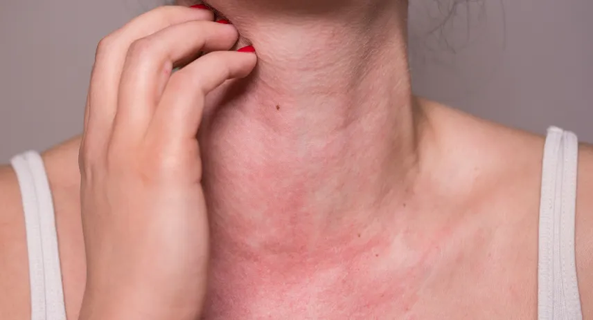 Non Allergenic Carpet for Your Healthy Home